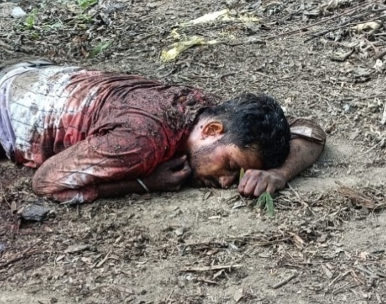 Korba: कोहड़िया नाले के पास खून से लथपथ मिली अज्ञात युवक की लाश, जाँच में जुटी पुलिस IMG 20260510 093748
